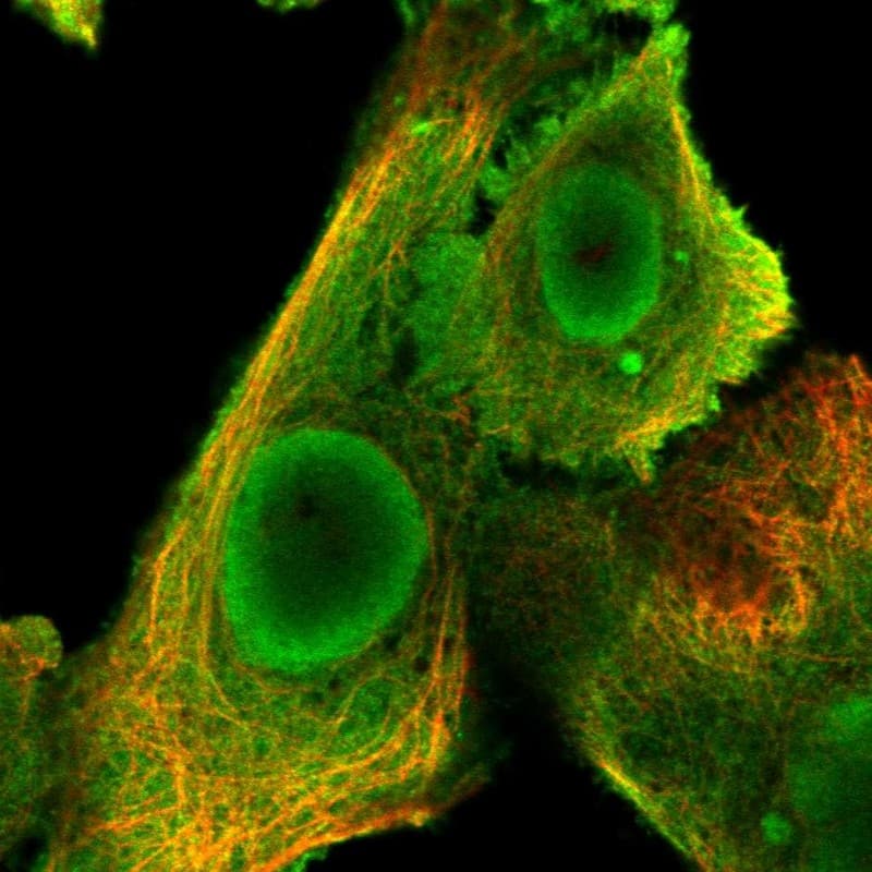 Staining of human cell line PC-3 shows localization to nucleoplasm, plasma membrane & cytosol.