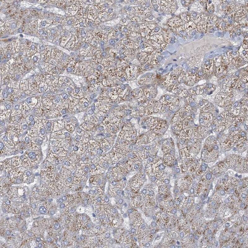Staining of human liver shows moderate cytoplasmic positivity in hepatocytes.