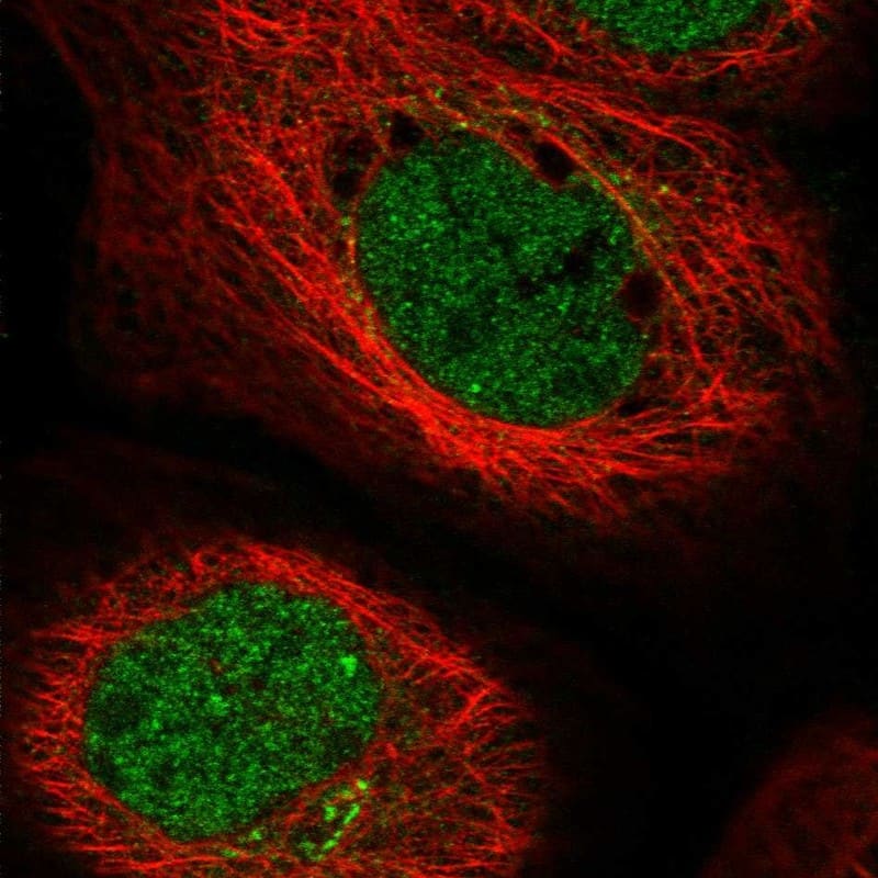 Staining of human cell line A-431 shows localization to nucleoplasm & the Golgi apparatus.