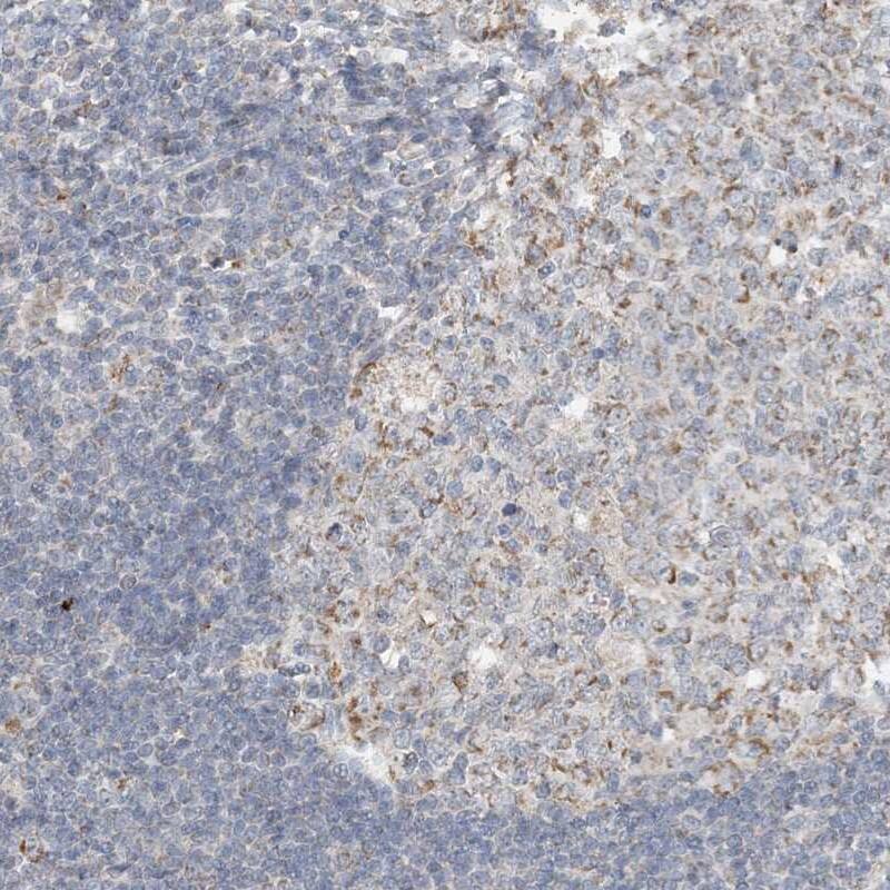 Staining of human appendix shows cytoplasmic positivity in lymphoid tissue.