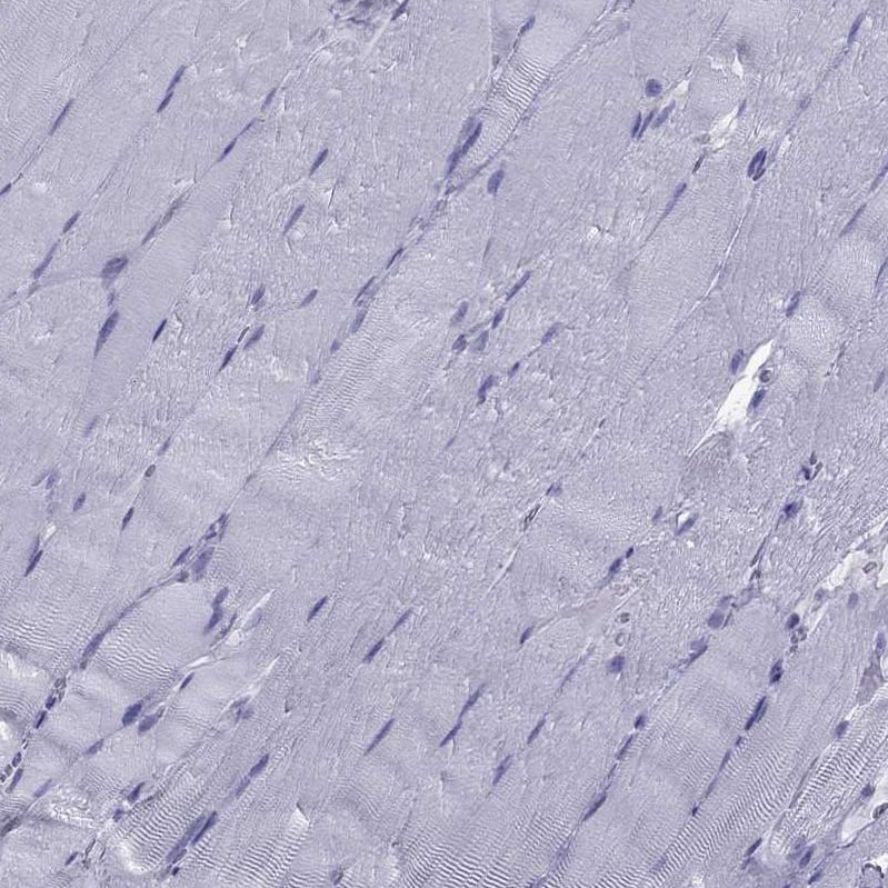 Staining of human skeletal muscle shows no positivity in myocytes as expected.