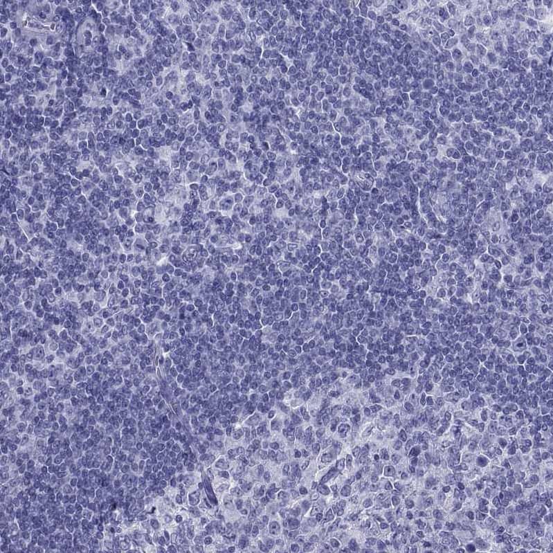 Staining of human tonsil shows no positivity in lymphoid cells as expected.