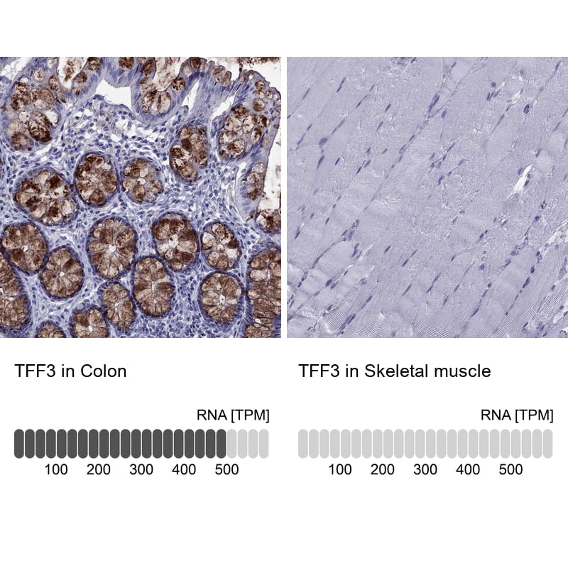 <b>Orthogonal Strategies Validation. </b>Analysis in human colon and skeletal muscle tissues. Corresponding RNA-seq data are presented for the same tissues.