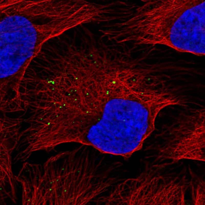 Immunocytochemistry/ Immunofluorescence KISS1 Antibody - BSA Free