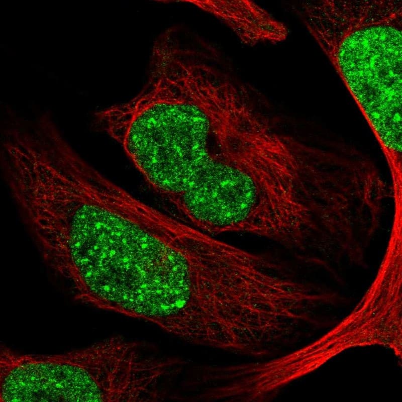 Immunocytochemistry/ Immunofluorescence CDYL Antibody - BSA Free