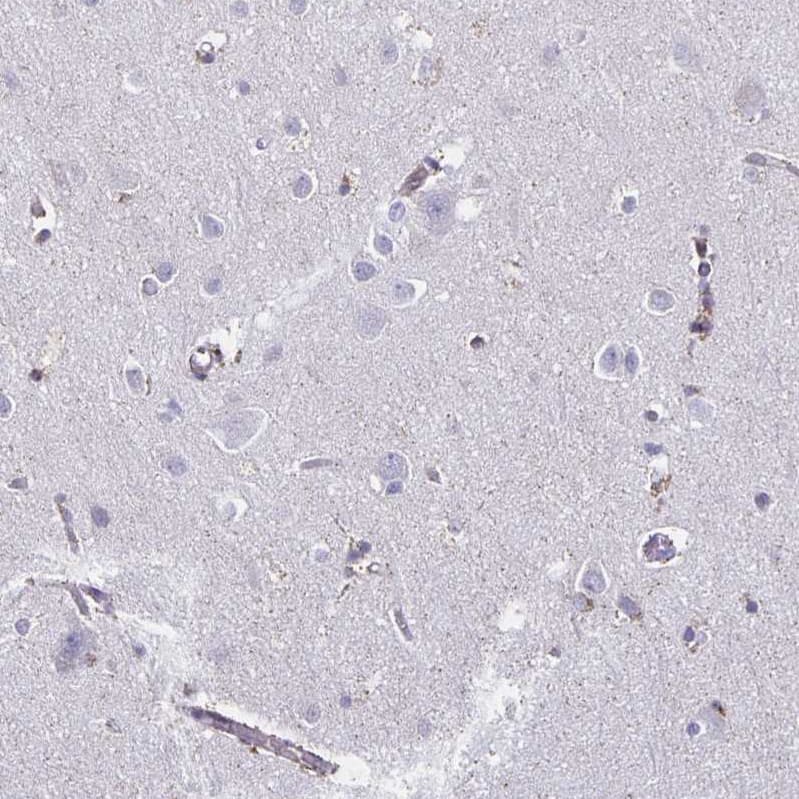 Staining of human cerebral cortex shows weak cytoplasmic-membranous positivity in endothelial cells.