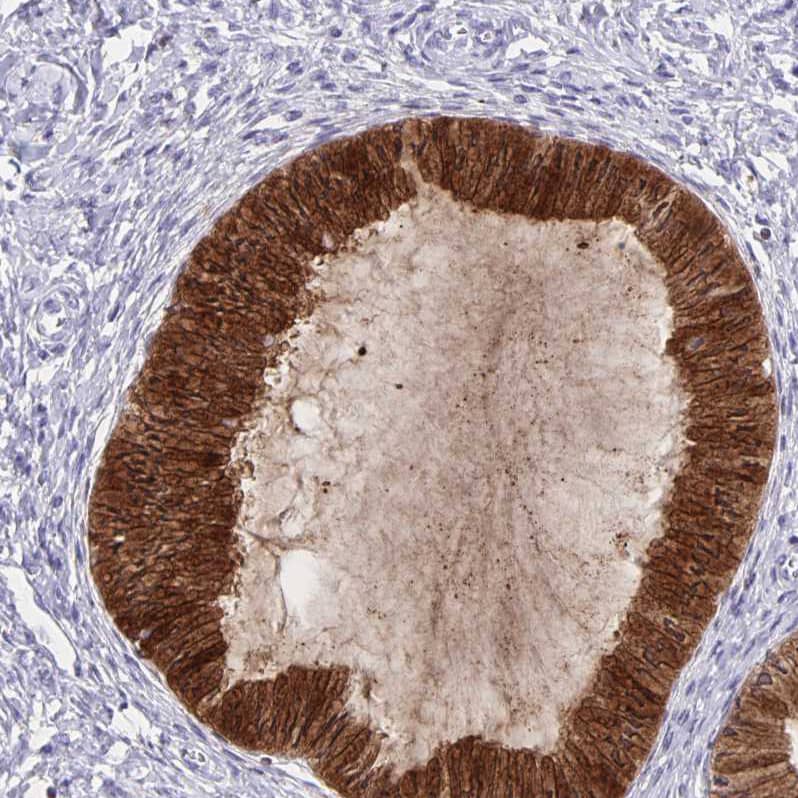 Staining of human cervix, uterine shows strong cytoplasmic-membranous positivity in glandular cells.