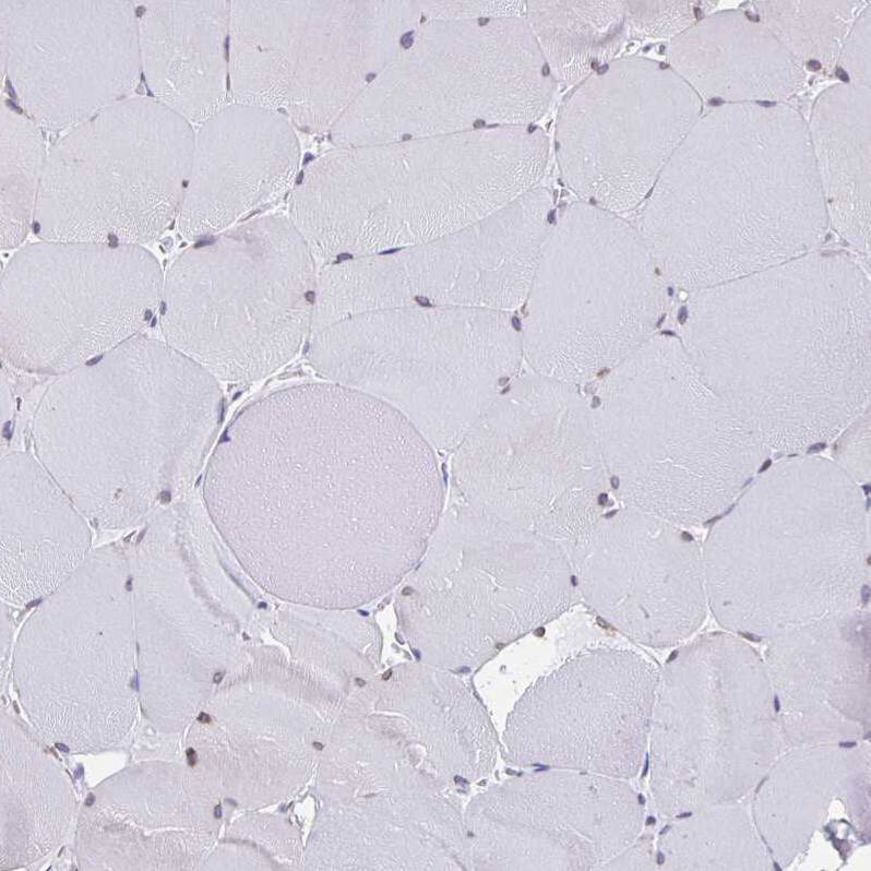 Staining of human skeletal muscle shows no positivity in myocytes as expected.
