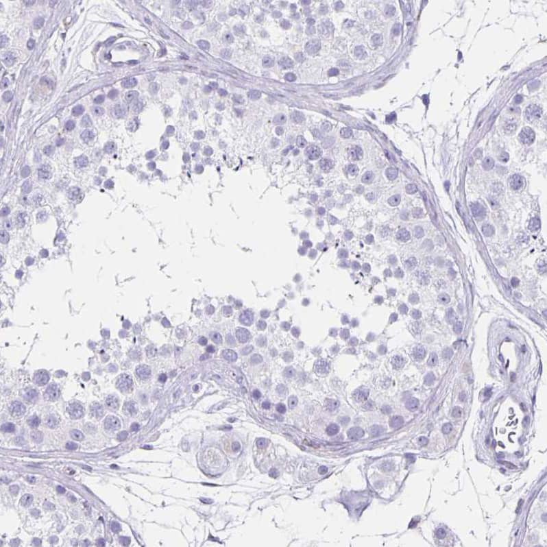 Staining of human testis shows no positivity in cells in seminiferous ducts as expected.
