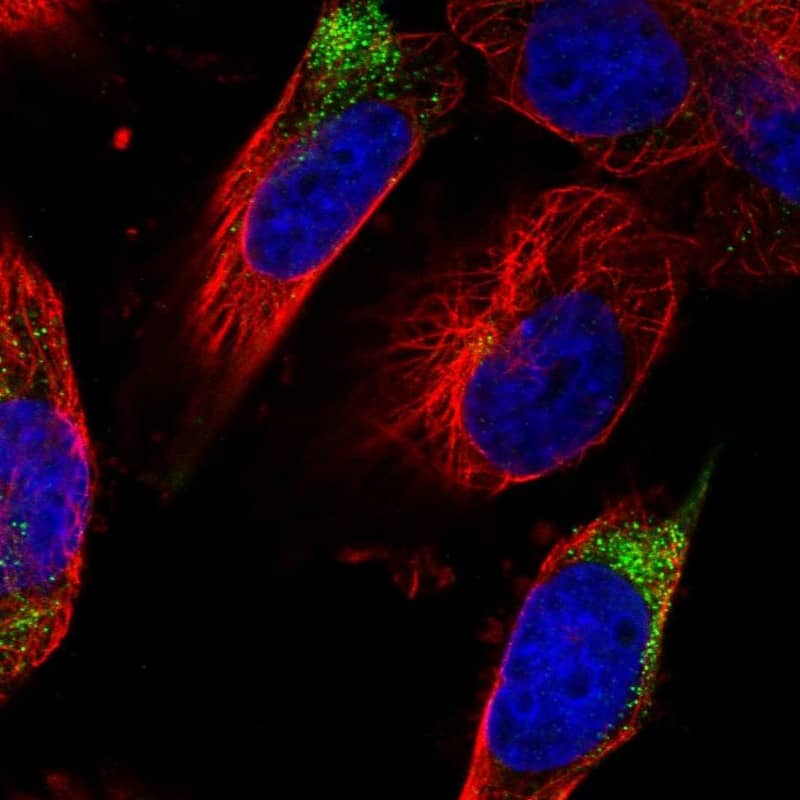 Staining of human cell line U-251 MG shows localization to cytosol.
