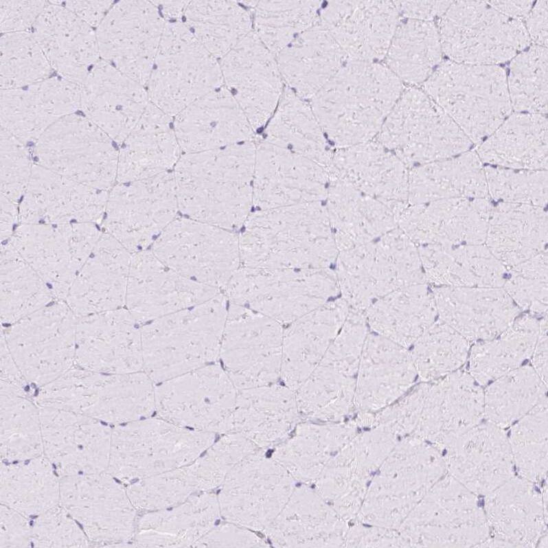 Staining of human skeletal muscle shows no positivity in myocytes as expected.