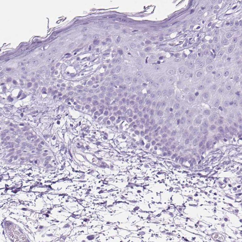 Staining of human skin shows no positivity in squamous epithelial cells as expected.