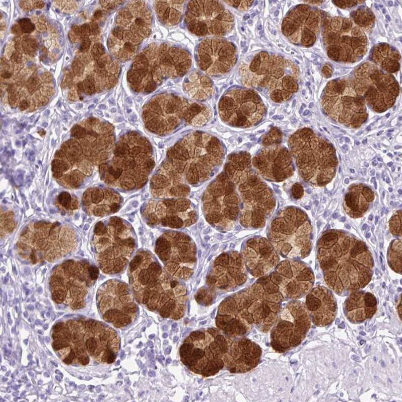Staining of human stomach shows strong membranous and cytoplasmic positivity in glandular cells.