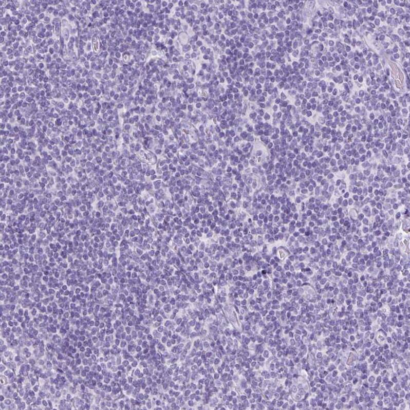 Staining of human tonsil shows no positivity in non-germinal center cells as expected.