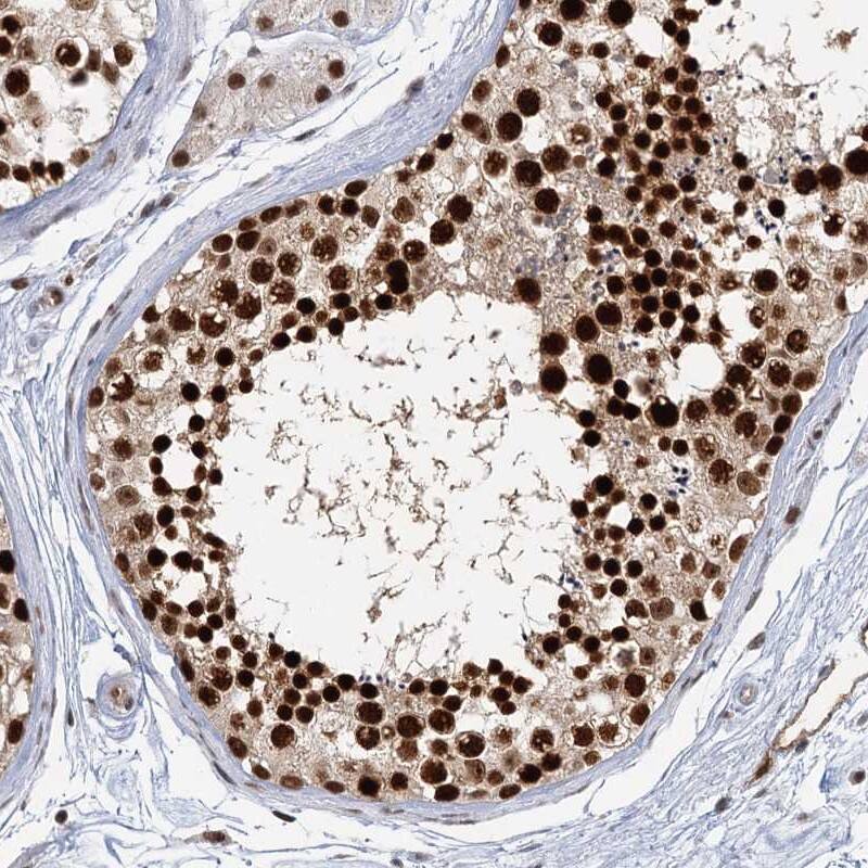 <b>Independent Antibodies Validation. </b>Staining of human testis shows strong nuclear positivity in cells in seminiferus ducts.