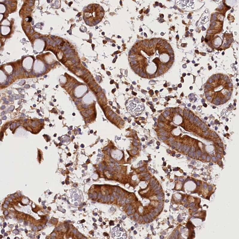 Immunohistochemistry-Paraffin SUV3L1 Antibody - BSA Free