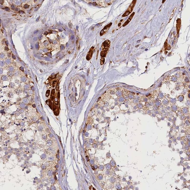 Immunohistochemistry-Paraffin SUV3L1 Antibody - BSA Free