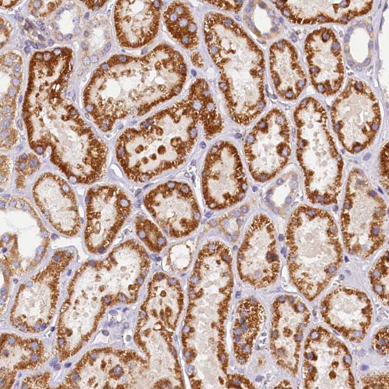 Immunohistochemistry-Paraffin SUV3L1 Antibody - BSA Free