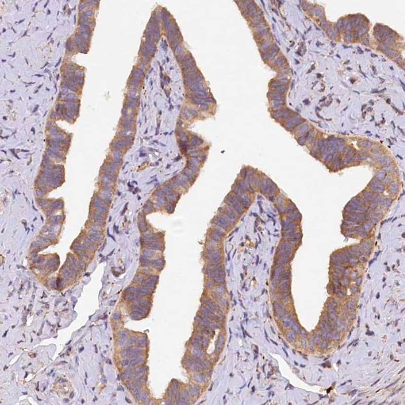 Immunohistochemistry-Paraffin SUV3L1 Antibody - BSA Free