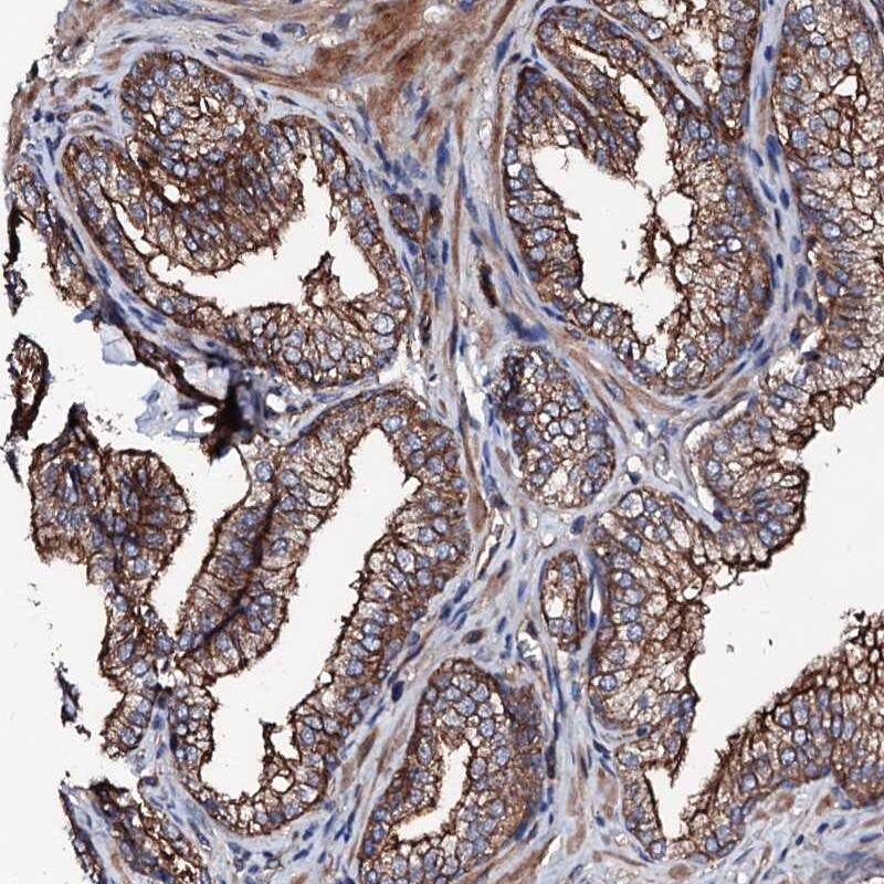 Immunohistochemistry-Paraffin LRRC35 Antibody - BSA Free