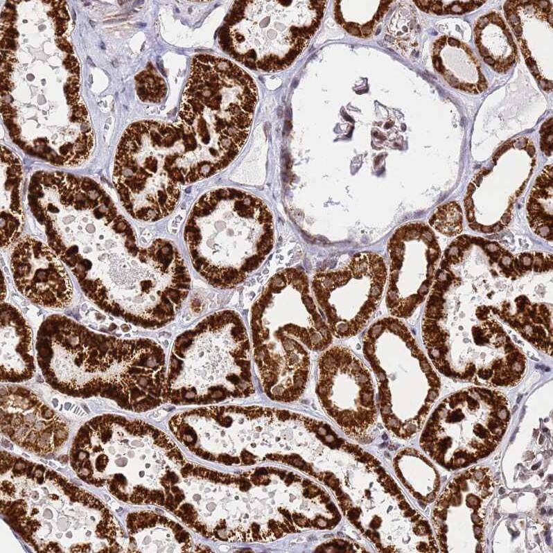 Staining of human kidney shows strong granular cytoplasmic positivity in cells in tubules.