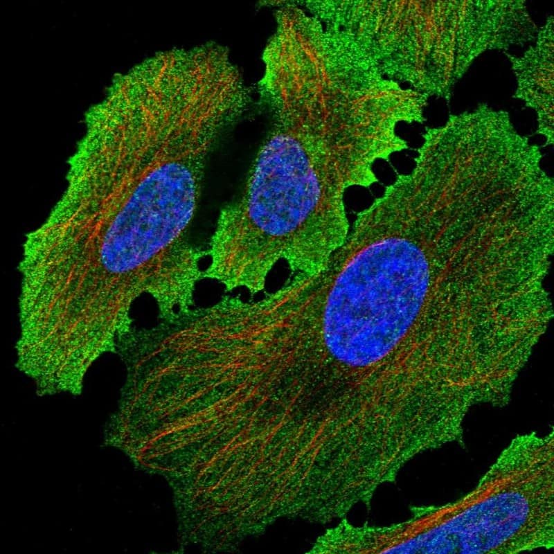 Staining of human cell line HeLa shows localization to plasma membrane.