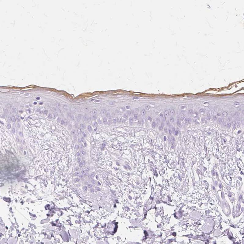 Staining of human skin shows moderate membranous positivity in squamous epithelial cells.