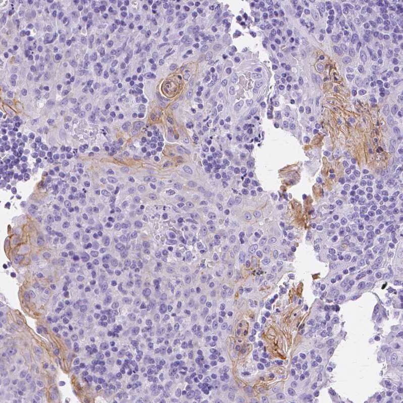 Staining of human tonsil shows moderate membranous positivity in squamous epithelial cells.