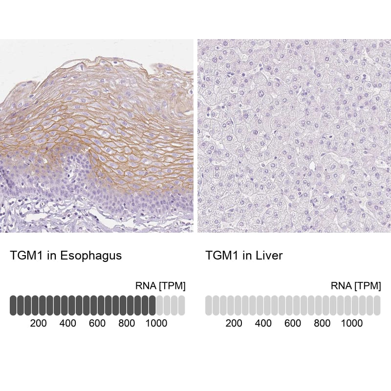 Analysis in human esophagus and liver tissues. Corresponding RNA-seq data are presented for the same tissues.