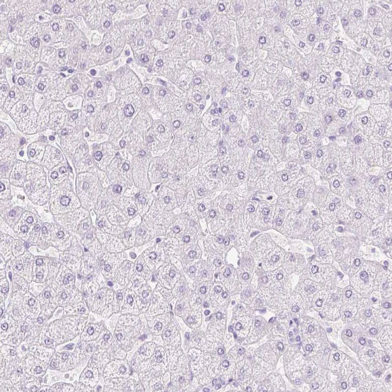 Staining of human liver shows no positivity in hepatocytes as expected.