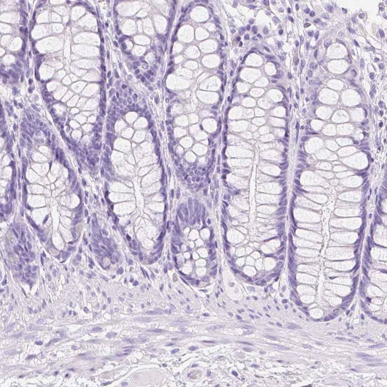 Staining of human colon shows no positivity in glandular cells as expected.