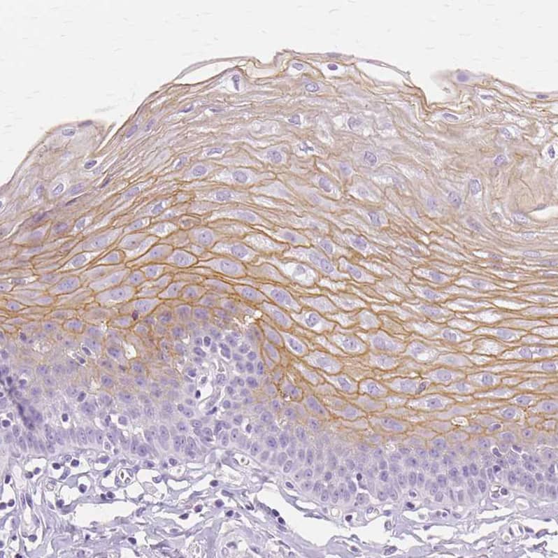 Staining of human esophagus shows moderate membranous positivity in squamous epithelial cells.