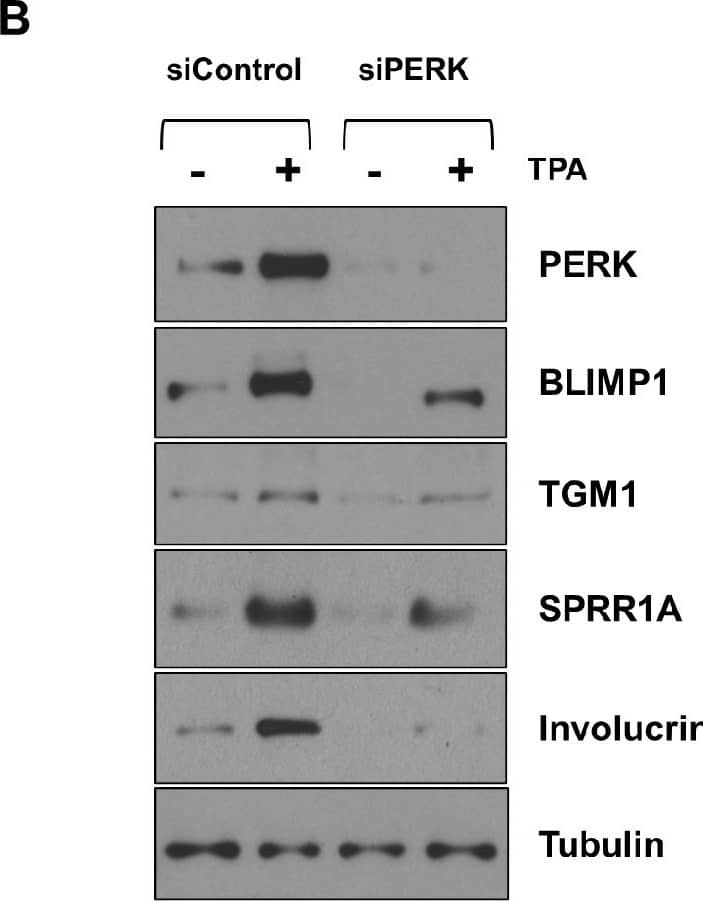 PERK is also required for efficient TPA-induced lytic EBV reactivation and differentiation in WT EBV-infected NOKs.WT EBV-infected NOKs cells were transfected with control siRNA or siRNAs against PERK as indicated, and then treated with TPA for 24 hours starting one day after siRNA transfection. (A) Immunoblot analyses were performed to examine the effect of PERK knock-down on EBV lytic proteins BZLF1, BRLF1, and BMRF1. (B) Immunoblot analyses were performed to examine the effect of PERK knock-down on differentiation-induced cellular proteins BLIMP1, TGM1, Involucrin and SPRR1A. Tubulin served as a loading control for both panels. The same extracts were used for both panels, and the same PERK and Tubulin blots were used for both panels. Image collected and cropped by CiteAb from the following open publication (//pubmed.ncbi.nlm.nih.gov/39951426), licensed under a CC-BY license. Not internally tested by Novus Biologicals.