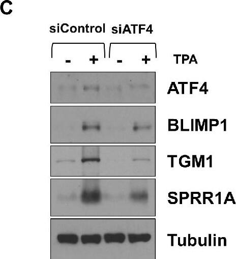 ATF4 and CHOP are required for efficient TPA-induced lytic EBV reactivation and differentiation in WT EBV-infected NOKs.WT EBV-infected NOKs cells were transfected with control siRNA or siRNAs against ATF4 (A and C) or CHOP (B and D) as indicated, and then treated with TPA for 24 hours starting one day after siRNA transfection. (A and B) Immunoblot analyses were performed to examine the effect of ATF4 and CHOP knock-down on lytic EBV proteins BZLF1, BRLF1, BMRF1 and p18 VCA as indicated. (C and D) Immunoblot analyses were performed to examine the effect of ATF4 and CHOP knock-down on TPA-induced differentiation markers BLIMP1, TGM1, and SPRR1A as indicated. Tubulin served as a loading control. The cellular extracts used in (A) and (C) or (B) and (D) were the same. The same ATF4 and Tubulin blots were used in (A) and (C), and the same CHOP and Tubulin blots were used for (B) and (D). Image collected and cropped by CiteAb from the following open publication (//pubmed.ncbi.nlm.nih.gov/39951426), licensed under a CC-BY license. Not internally tested by Novus Biologicals.