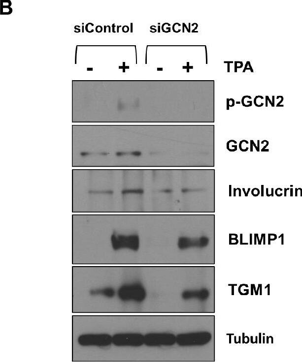GCN2 is required for TPA-induced lytic EBV reactivation and differentiation in WT EBV-infected NOKs.WT EBV-infected NOKs cells were transfected with control siRNA or siRNAs against GCN2 as indicated, and then treated with TPA for 24 hours starting one day after siRNA transfection. (A) Immunoblot analysis was performed to examine the effect of GCN2 knock-down on proteins involved in the ISR pathway (including p-GCN2, GCN2, p-eIF2 alpha , eiF2 alpha , ATF4, and CHOP) and EBV lytic proteins (BZLF1, BRLF1, BMRF1, and p18 VCA). (B) Immunoblot analyses were performed to examine the effect of GCN2 knock-down on differentiation-induced cellular proteins Involucrin, BLIMP1, and TGM1. Tubulin served as a loading control for both panels. The same extracts were used for each panel, and the same GCN2, p-GCN2, and Tubulin blots were used for both panels. Image collected and cropped by CiteAb from the following open publication (//pubmed.ncbi.nlm.nih.gov/39951426), licensed under a CC-BY license. Not internally tested by Novus Biologicals.