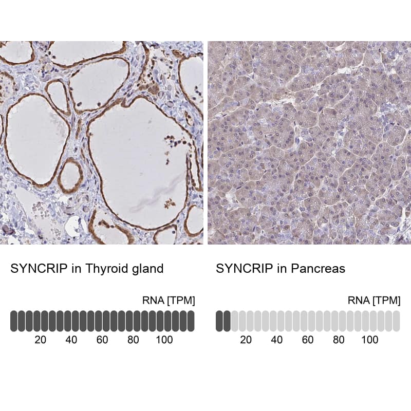 Immunohistochemistry-Paraffin hnRNP-Q Antibody - BSA Free