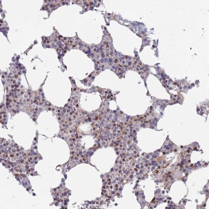 Staining of human bone marrow shows nuclear positivity in hematopoietic cells.