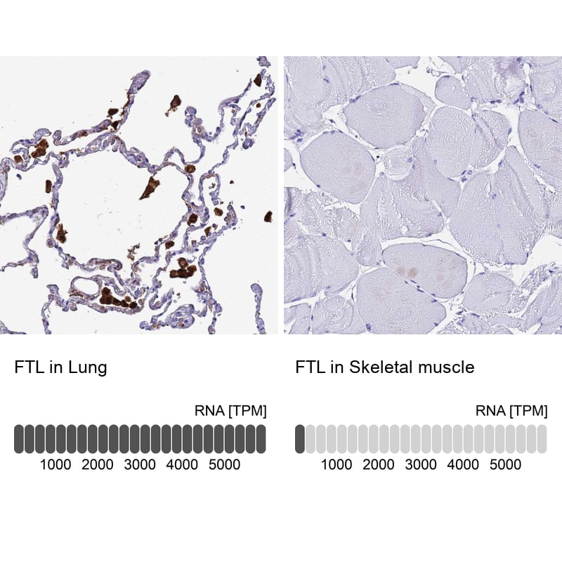 <b>Orthogonal Strategies Validation. </b>Analysis in human lung and skeletal muscle tissues. Corresponding RNA-seq data are presented for the same tissues.