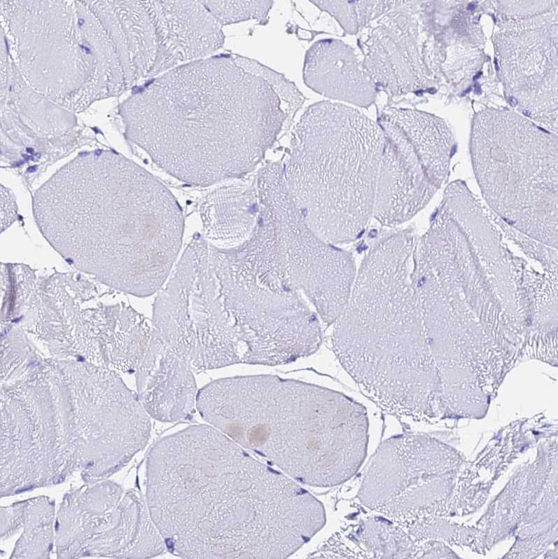 Staining of human skeletal muscle shows no positivity in myocytes as expected.