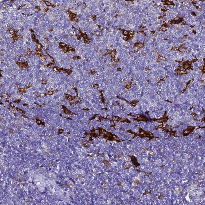 Staining of human tonsil shows strong cytoplasmic positivity in germinal center cells.