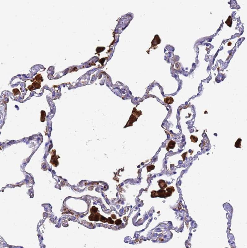 Staining of human lung shows strong cytoplasmic positivity in macrophages.