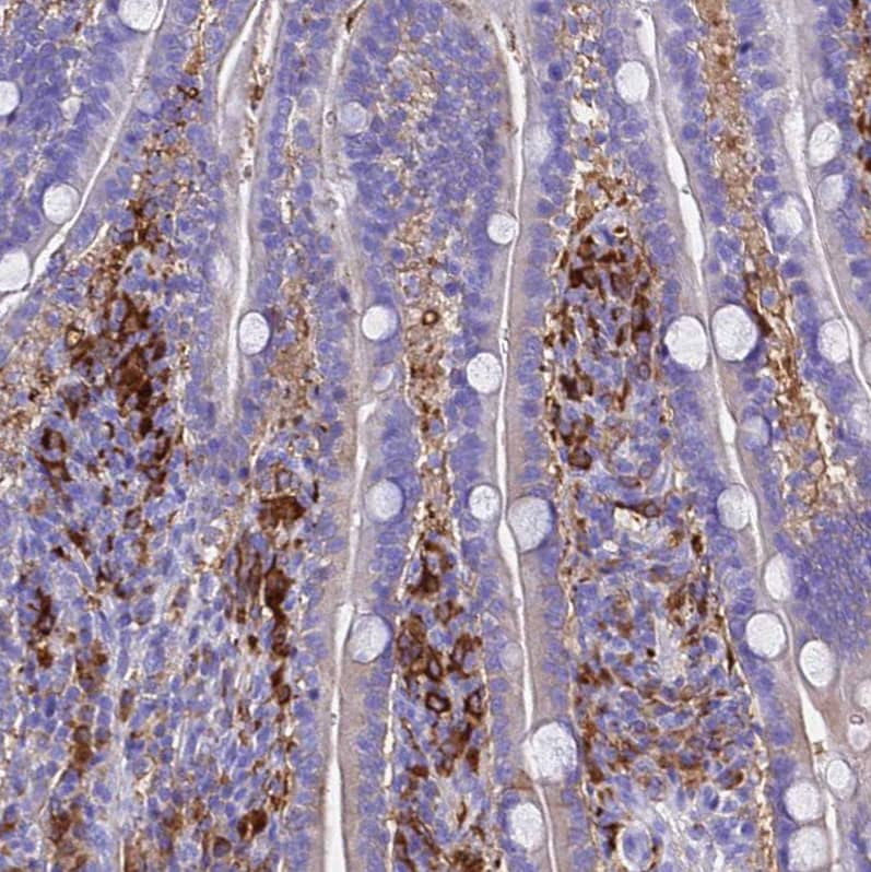 Staining of human duodenum shows strong cytoplasmic positivity in lymphoid cells.