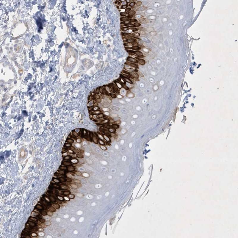 Immunohistochemistry-Paraffin CCDC24 Antibody - BSA Free