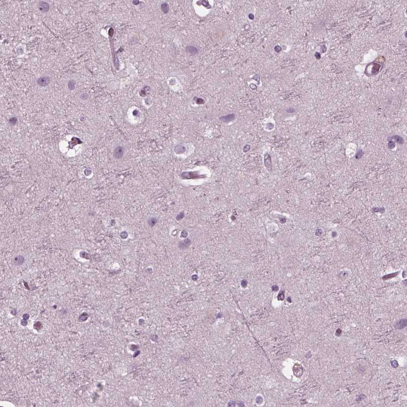Staining of human cerebral cortex shows no positivity in neurons as expected.