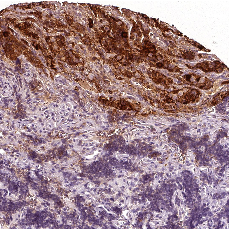 Staining of human pituitary gland shows strong cytoplasmic positivity in anterior lobe.