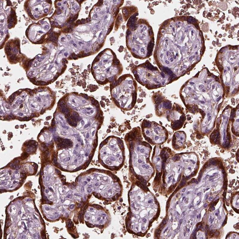 Staining of human placenta shows strong cytoplasmic positivity in trophoblastic cells.