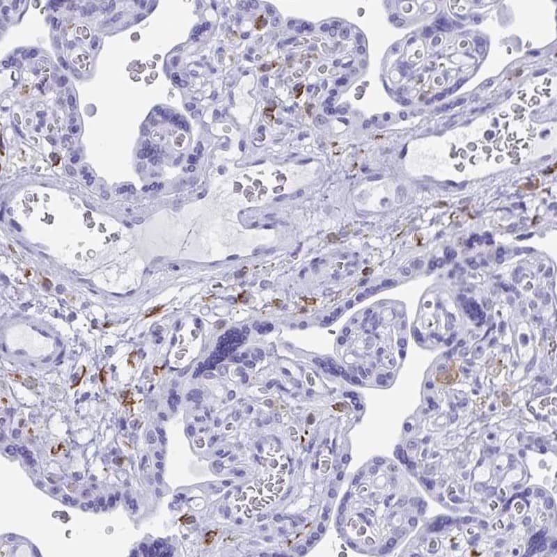 Immunohistochemistry-Paraffin ZNF850 Antibody - BSA Free