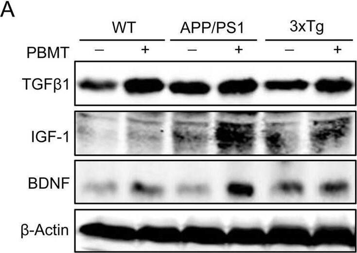 The upregulation of TGF beta 1/IGF-1/BDNF expression in the brain of AD mice by PBMT extended to promote adult hippocampal neurogenesis. A, B Western blotting analysis (A) and quantification (B) of TGF beta 1/IGF-1/BDNF expression in APP/PS1 and 3xTg-AD mouse brain after PBMT, (n = 3–4 per group). C The concentration of TGF beta 1/IGF-1/BDNF in brain tissues were measured by enzyme linked immunosorbent assay (ELISA), (n = 3–6 per group). D Representative images of Nestin+ (neural stem cell staining) and neuronal class-III  beta -tubulin (Tuj1)+ (newborn neurons staining) expression cells in APP/PS1 and 3xTg-AD mouse hippocampal dentate gyrus (DG) at the end of PBMT. Scale bars, 50 μm. E Quantitative analyses of Nestin+ and Tuj1+ area in the hippocampal DG of each group, (n = 4 per group). F Quantitative analyses of the Nestin and Tuj1 mean fluorescence (MFI) in the brain tissues of each group after PBMT. The Nestin and Tuj1 MFI were detected by flow cytometer, (n = 5–6 per group). G Tuj1 antibody was used to staining the newborn neurons, and then, the expression of  alpha -amino-3-hydroxy-5-methyl-4-isoxazole-propionic acid receptors (AMPAR) and postsynaptic density protein 95 (PSD95) on Tuj1+ neurons were detected by flow cytometer. All quantifications are presented as mean +/- SEM and were analyzed by one-way ANOVA test; ***p < 0.001, **p < 0.01, *p < 0.05 versus WT group; ###p < 0.001, ##p < 0.01, #p < 0.05 versus indicated group Image collected and cropped by CiteAb from the following open publication (//pubmed.ncbi.nlm.nih.gov/36217178), licensed under a CC-BY license. Not internally tested by Novus Biologicals.