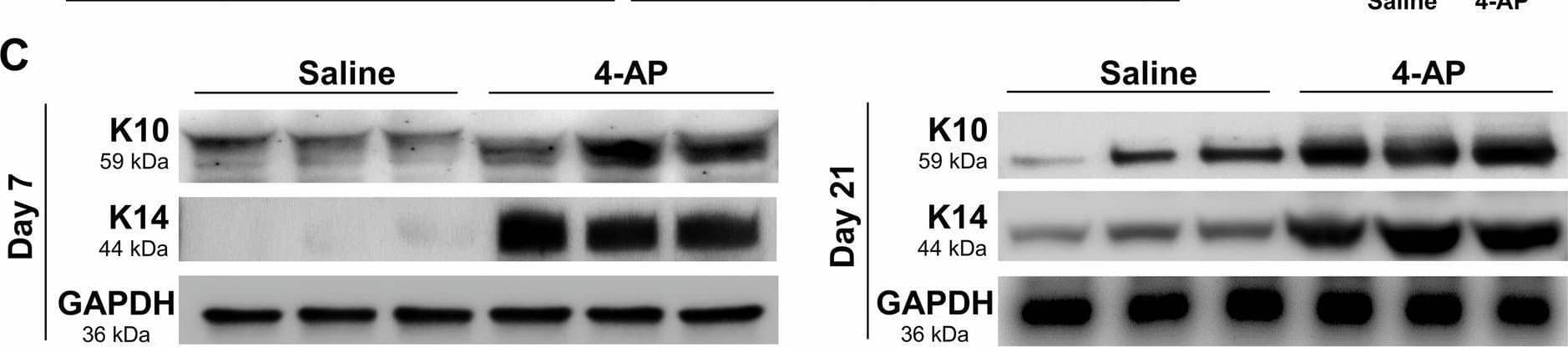 4-AP accelerated epithelization and keratinocytes terminal differentiation following skin burn.A, B Representative images and quantitative results of IF staining of keratinocyte markers (K10; terminal differentiation and K14; proliferative) in saline and 4-AP treated skin burn tissues on days 3 and 7. Scale bar = 100 um. n = 4 skin tissues per group. C, D Western blotting and (E) qRT-PCR quantitative results show that 4-AP treatment significantly increased keratin markers protein and gene (K10 and K14) expressions compared to the saline group on days 3 and 7. n = 3 skin tissues per group. Data are represented as mean +/- SEM. The statistical significance is indicated by asterisks (*P < 0.05, **P < 0.0021, and ***P < 0.0002 vs. saline group) and compared using two-tailed, unpaired t-tests. Image collected and cropped by CiteAb from the following open publication (//pubmed.ncbi.nlm.nih.gov/39366954), licensed under a CC-BY license. Not internally tested by Novus Biologicals.