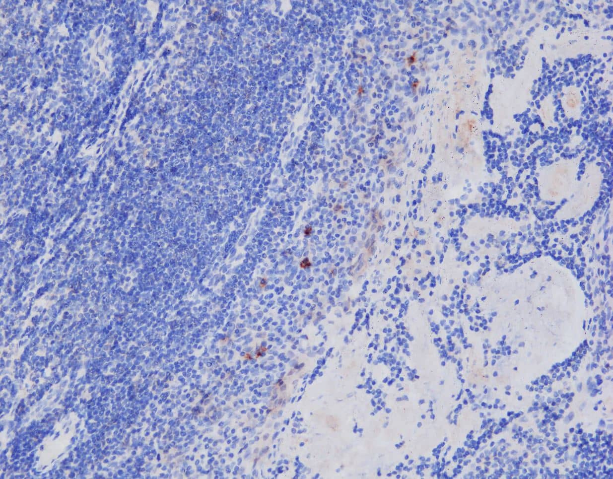 Immunohistochemistry-Paraffin: CD1a Antibody (O10+C1A/711) [NBP2-34314] - Analysis of CD1a on human tonsil tissue. 1ug/mL primary antibody. Heat induced epitope retrieval in a basic buffer. Image from a verified customer review.